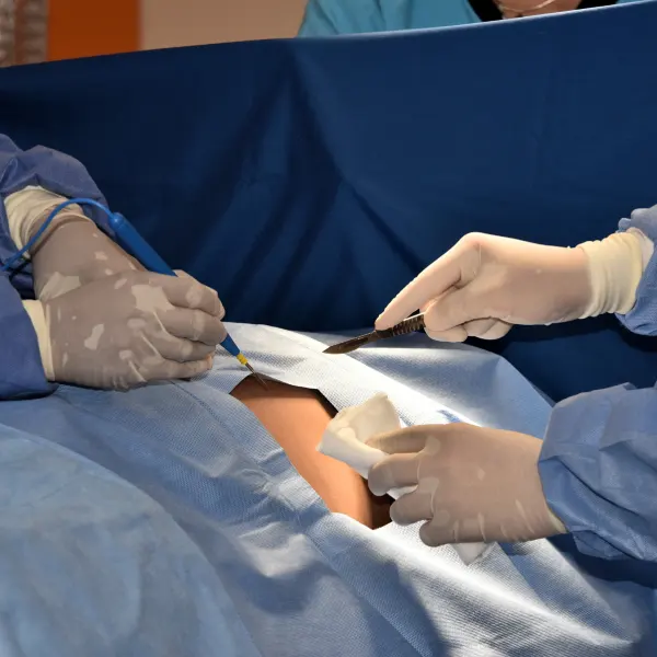 Kidney Biopsy Kidney Biopsy