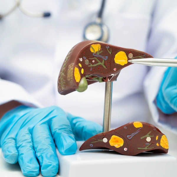 Liver Biopsy Liver Biopsy