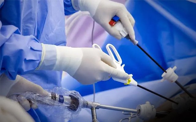 Surgeons performing a laparoscopic surgery using minimally invasive instruments through small incisions, commonly used for abdominal and gynecological procedures