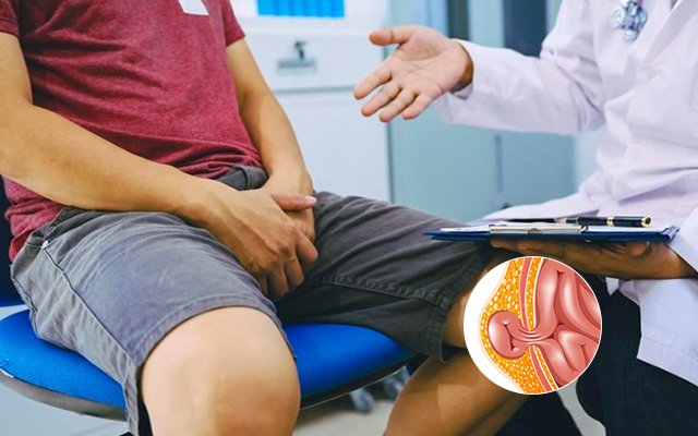 inguinal-hernia-diagnosis-doctor-consultation Doctor consulting a male patient with an anatomical illustration showing an inguinal hernia in the groin area.